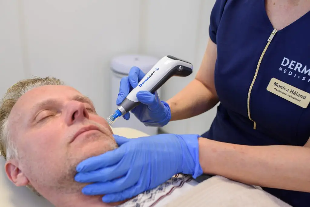 DermaPen_Microneedling_Behandling_Stavanger_DermaMediSpa fotona laserbehandlinger twinlight resurfacing stavanger